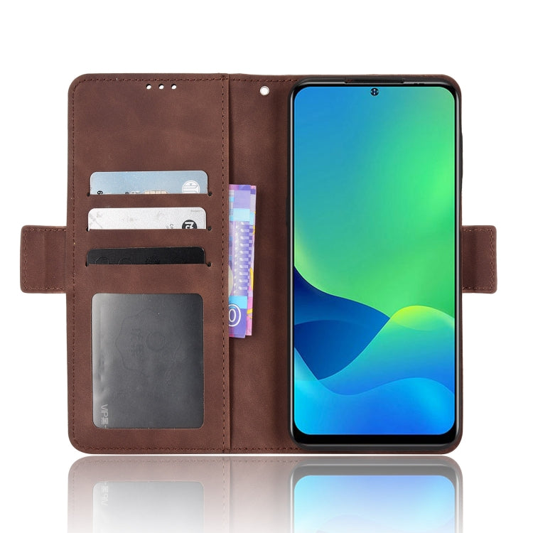 For Ulefone Note 13P Skin Feel Calf Pattern Leather Phone Case(Brown) - Ulefone Cases by buy2fix | Online Shopping UK | buy2fix