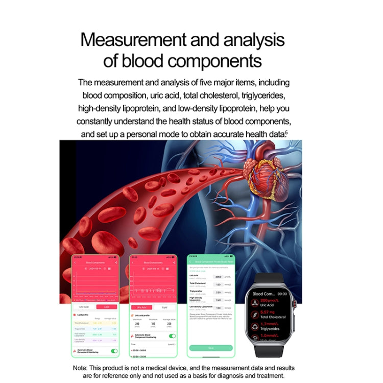 ET585 2.04 inch Nylon Strap IP68 Waterproof Smart Watch, Support ECG / Blood Composition Measurement(Green) - Smart Watches by buy2fix | Online Shopping UK | buy2fix