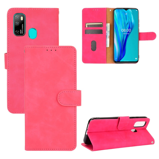 For Ulefone Note 9P Solid Color Skin Feel Magnetic Buckle Horizontal Flip Calf Texture PU Leather Case with Holder & Card Slots & Wallet(Rose Red) - Ulefone Cases by buy2fix | Online Shopping UK | buy2fix